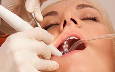 sedation dentistry facts That you didn’t know